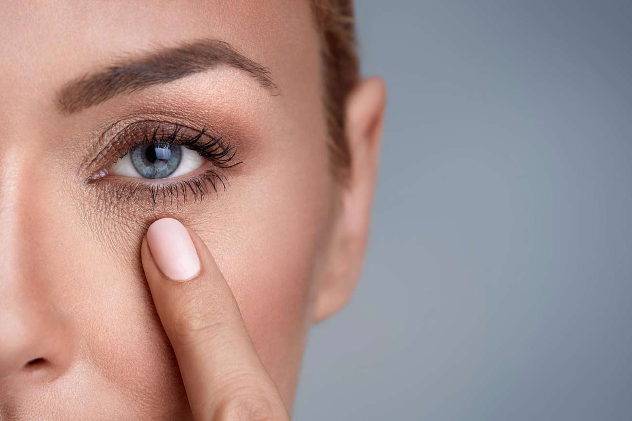 تیرگی چشم علل و درمان تیرگی های اطراف چشم